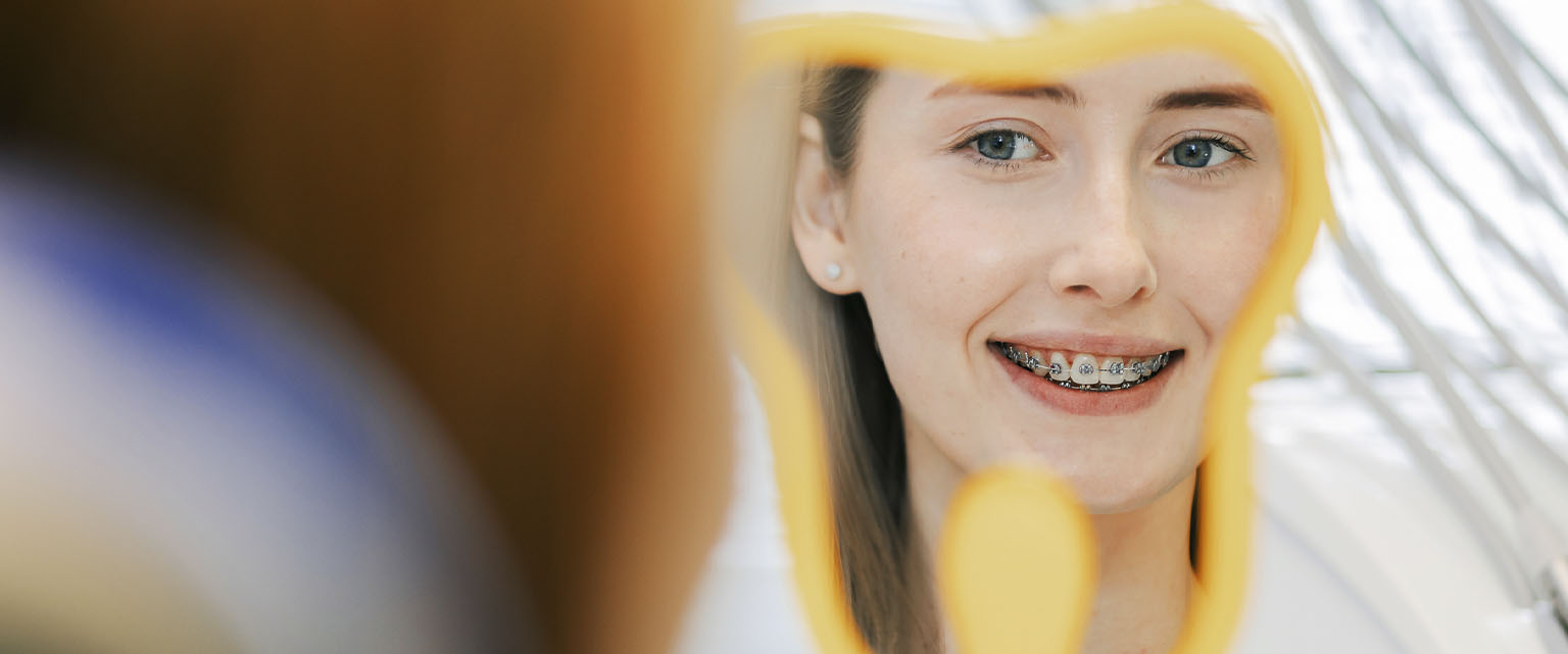 Брекет-системи